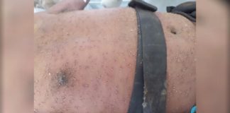 Itabirito/Ouro Preto: Após ataque de abelhas, homem é levado em estado grave para o João XXIII