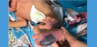 Ouro Preto: mãe implora ajuda para salvar a vida do filho; veja vídeo