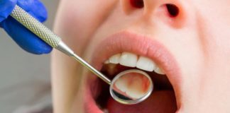 Consultas odontológicas na rede pública de Itabirito agora serão agendadas pela internet