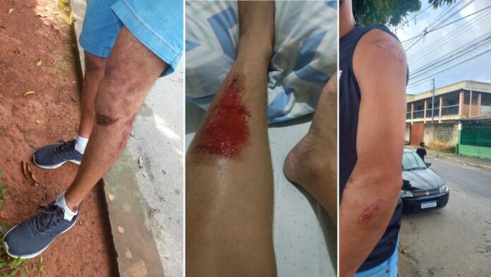 Ela se feriu na perna (imagem central); e ele, no braço e também na perna (imagens laterais). Fotos enviadas ao Radar Geral pelas vítimas