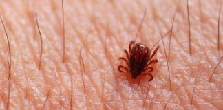 Febre maculosa: professora da Alis Itabirito explica doença transmitida pelo carrapato-estrela Febre maculosa: professora da Alis Itabirito explica doença transmitida pelo carrapato-estrela