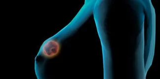 Outubro Rosa: professora da Alis Itabirito explica sobre câncer de mama e do colo do útero Outubro Rosa: professora da Alis Itabirito explica sobre câncer de mama e do colo do útero