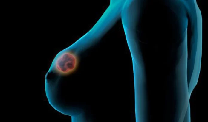 Outubro Rosa: professora da Alis Itabirito explica sobre câncer de mama e do colo do útero