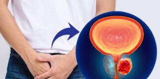 Professora da Alis Itabirito: “Câncer de próstata em estágios iniciais tem chances de cura” Professora da Alis Itabirito: “Câncer de próstata em estágios iniciais tem chances de cura”