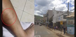 Panturrilha mordida e tênis arrancado: pela 3ª vez, cães de catadora atacam uma motociclista de Itabirito A esquerda, marca da mordida do animal. A direita local do ocorrido. Foto enviada ao Radar Geral e Google Street View.