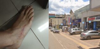 Itabirito: cachorros de rua atacam motociclistas e deixam uma mulher com o pé ferido Itabirito: cachorros de rua atacam motociclistas e deixa uma mulher com o pé ferido