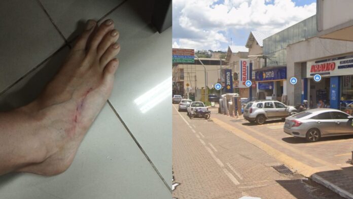 Itabirito: cachorros de rua atacam motociclistas e deixa uma mulher com o pé ferido
