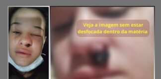 Congonhas: com 3 filhos, mãe criada em Ouro Branco sofre com tumor raro e pede ajuda de internautas Congonhas: com 3 filhos, mãe criada em Ouro Branco sofre com tumor raro e pede ajuda de internautas