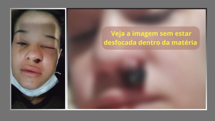 Congonhas: com 3 filhos, mãe criada em Ouro Branco sofre com tumor raro e pede ajuda de internautas