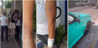 Itabirito: discussão de motorista e pedestre teve chute em carro, mordida em pulso de mulher e ação da GCM Itabirito: discussão de motorista e pedestre teve chute em carro, mordida no pulso de mulher e ação da GCM