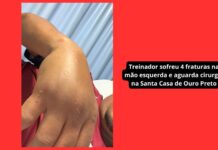 Treinador do Itabirito sub-11 sofre 4 fraturas após ataque de pai de ex-aluno: ‘Quis acertar minha cabeça’ Treinador do Itabirito sub-11 sofre 4 fraturas após ataque de pai de ex-aluno: 'Quis acertar minha cabeça'