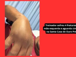 Treinador do Itabirito sub-11 sofre 4 fraturas após ataque de pai de ex-aluno: ‘Quis acertar minha cabeça’ Treinador do Itabirito sub-11 sofre 4 fraturas após ataque de pai de ex-aluno: 'Quis acertar minha cabeça'