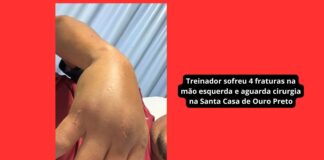 Treinador do Itabirito sub-11 sofre 4 fraturas após ataque de pai de ex-aluno: ‘Quis acertar minha cabeça’ Treinador do Itabirito sub-11 sofre 4 fraturas após ataque de pai de ex-aluno: 'Quis acertar minha cabeça'