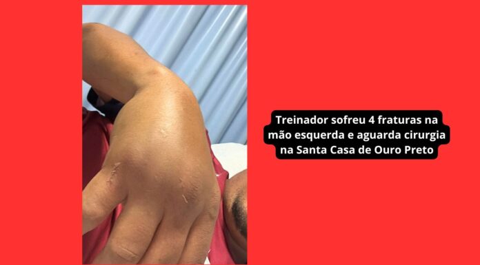 Treinador do Itabirito sub-11 sofre 4 fraturas após ataque de pai de ex-aluno: ‘Quis acertar minha cabeça’ Treinador do Itabirito sub-11 sofre 4 fraturas após ataque de pai de ex-aluno: 'Quis acertar minha cabeça'