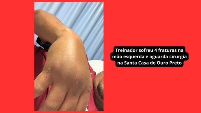 Treinador do Itabirito sub-11 sofre 4 fraturas após ataque de pai de ex-aluno: 'Quis acertar minha cabeça'
