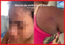 ‘Dei tanto nessa mulher que minha mão está inchada’, diz patroa que torturou doméstica grávida ‘Dei tanto nessa mulher que minha mão está inchada’, diz patroa que torturou doméstica grávida