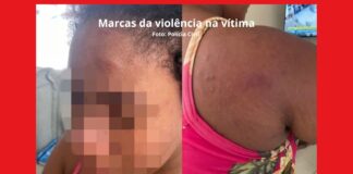 ‘Dei tanto nessa mulher que minha mão está inchada’, diz patroa que torturou doméstica grávida ‘Dei tanto nessa mulher que minha mão está inchada’, diz patroa que torturou doméstica grávida