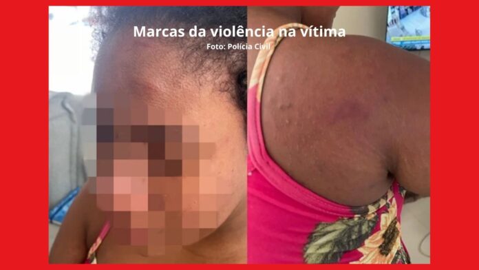 ‘Dei tanto nessa mulher que minha mão está inchada’, diz patroa que torturou doméstica grávida