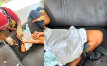 MG: criança de 3 anos derrama supercola no sofá, senta sobre o produto e fica presa MG: criança de 3 anos derrama supercola no sofá, senta sobre o produto e fica presa
